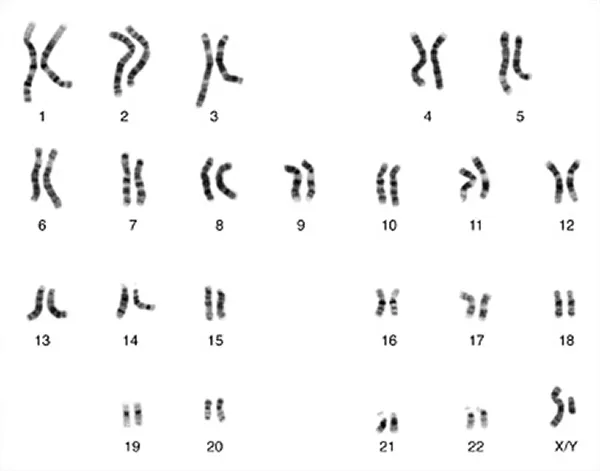 Kromosomer, 23 par i form av parallella streck på en vit bakgrund. Foto.